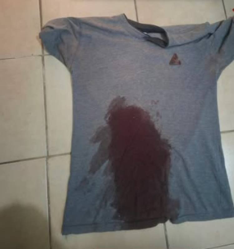 Nonogasta: una mujer denunció agresiones de su pareja y un hombre resultó herido con un arma blanca